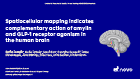 easd-2026-lundh-246-brain-mapping-02sep2026-final